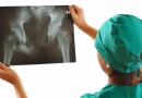 Keep osteoporosis far away from your bones