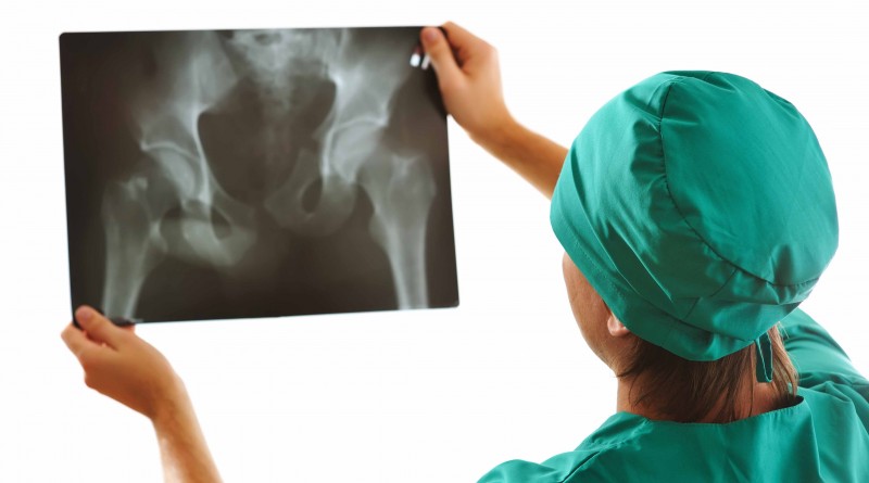 Keep osteoporosis far away from your bones