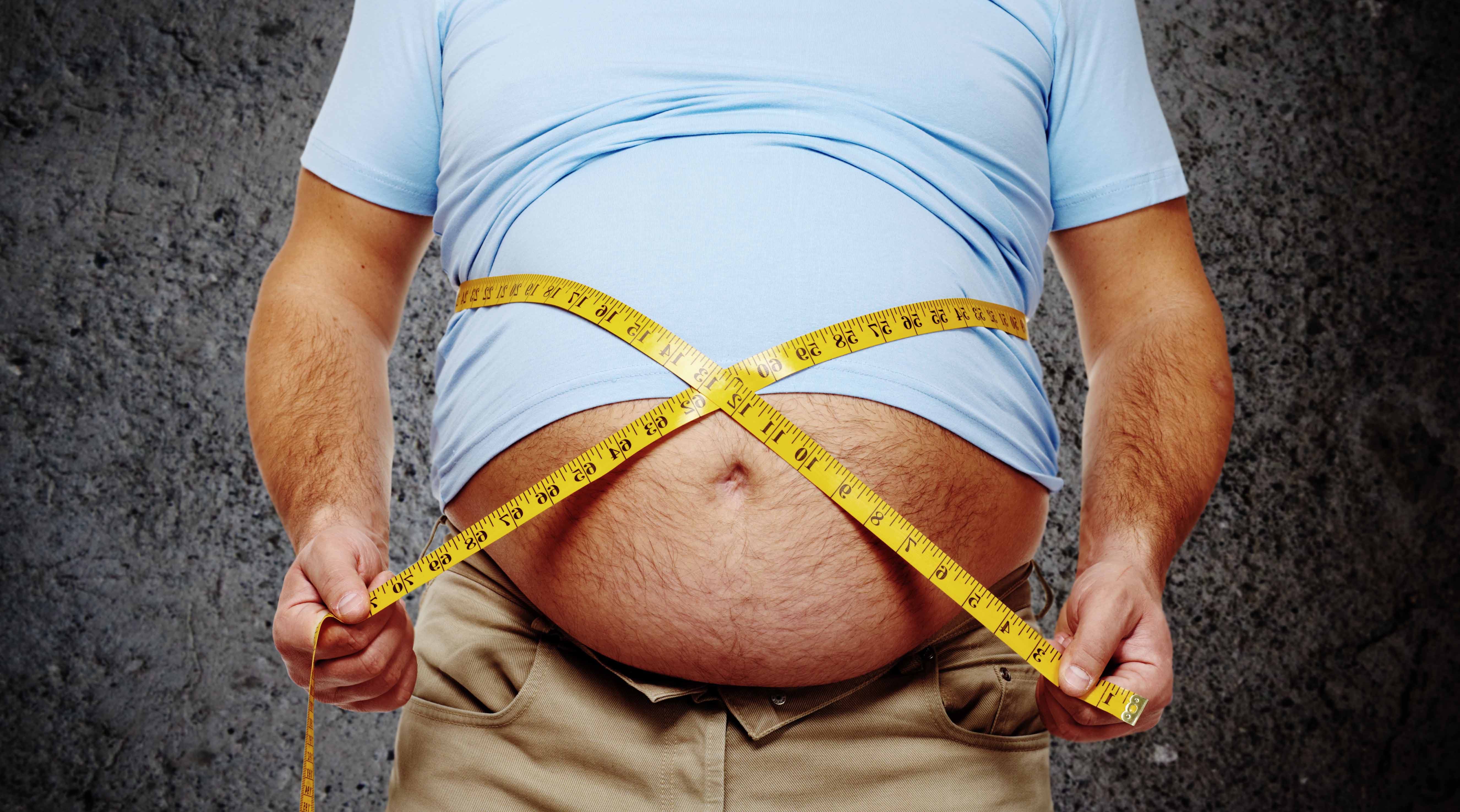 Страдающие лишним весом. Ожирение. Люди с избыточным весом.